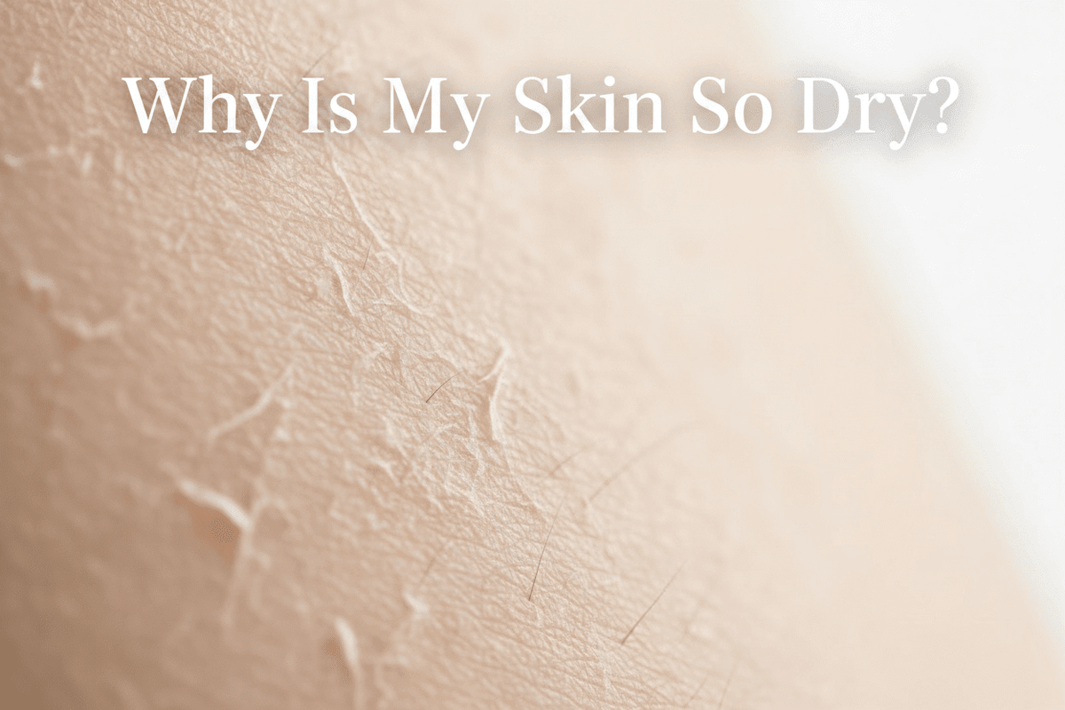 why is my skin so dry image of dry skin up close